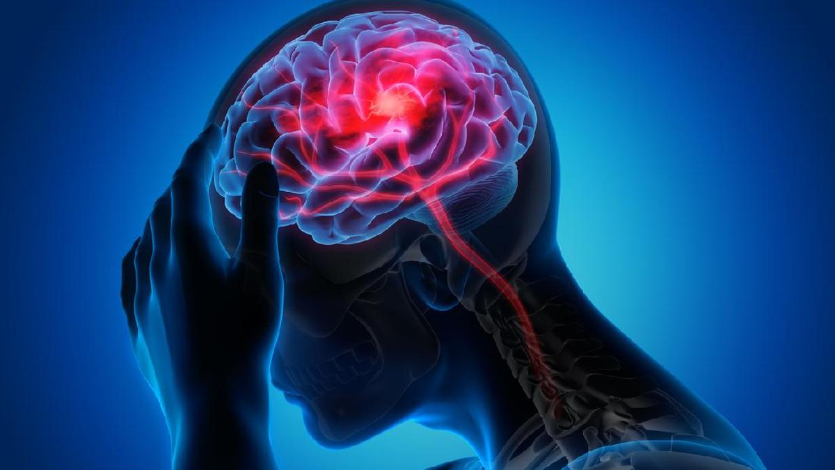 Alasan Kebiasaan Minum Teh Dapat Turunkan Risiko Stroke