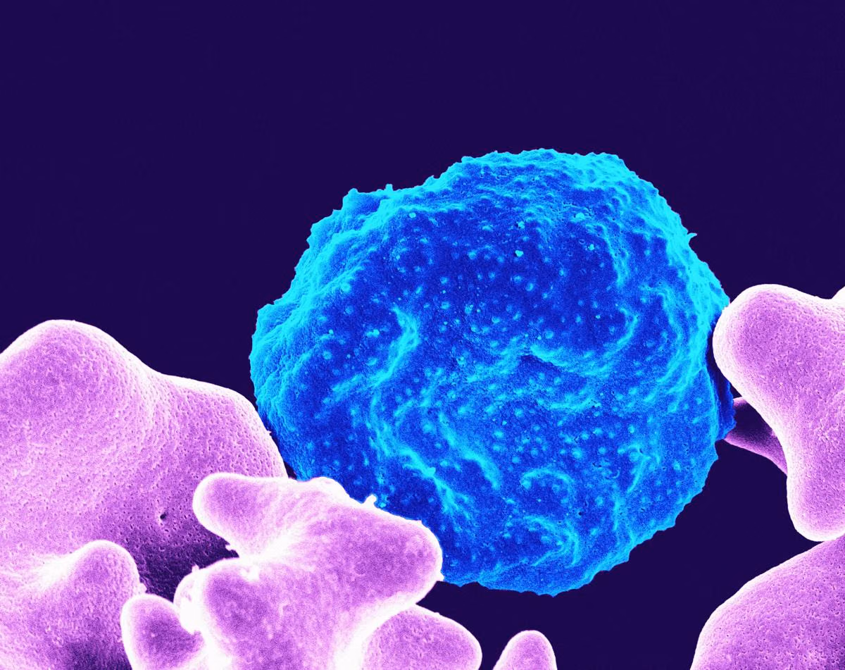 Dua Kasus Kematian Pertama di AS Terkait Wabah Siklosporiasis