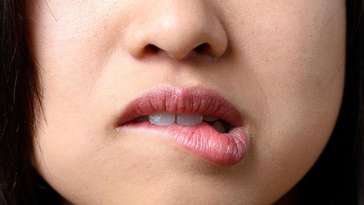 Perawatan Bibir Kering dan Pecah: Solusi yang Efektif
