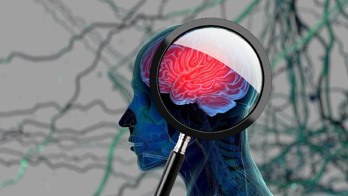Pola Makan Anti-Inflamasi Turunkan Risiko Demensia