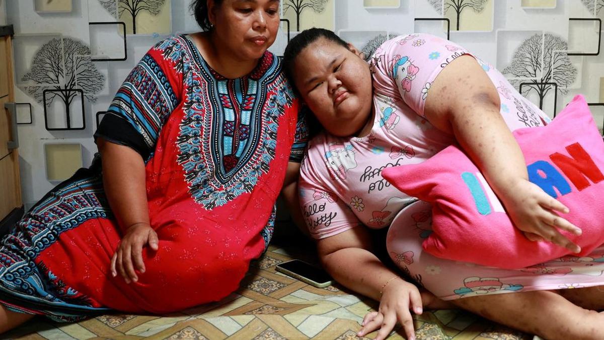 Kisah Menyedihkan Remaja Bogor yang Terpaksa Putus Sekolah Akibat Bullying dan Obesitas