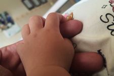 Penyakit Campak Masih Mengintai, Ratusan Kasus Terdeteksi di Subang, Waspada!