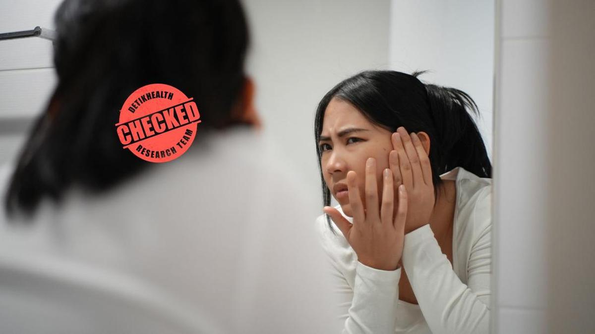 Pola Makan Ternyata Bisa Jadi Pemicu Jerawat Meski Rajin Cuci Muka
