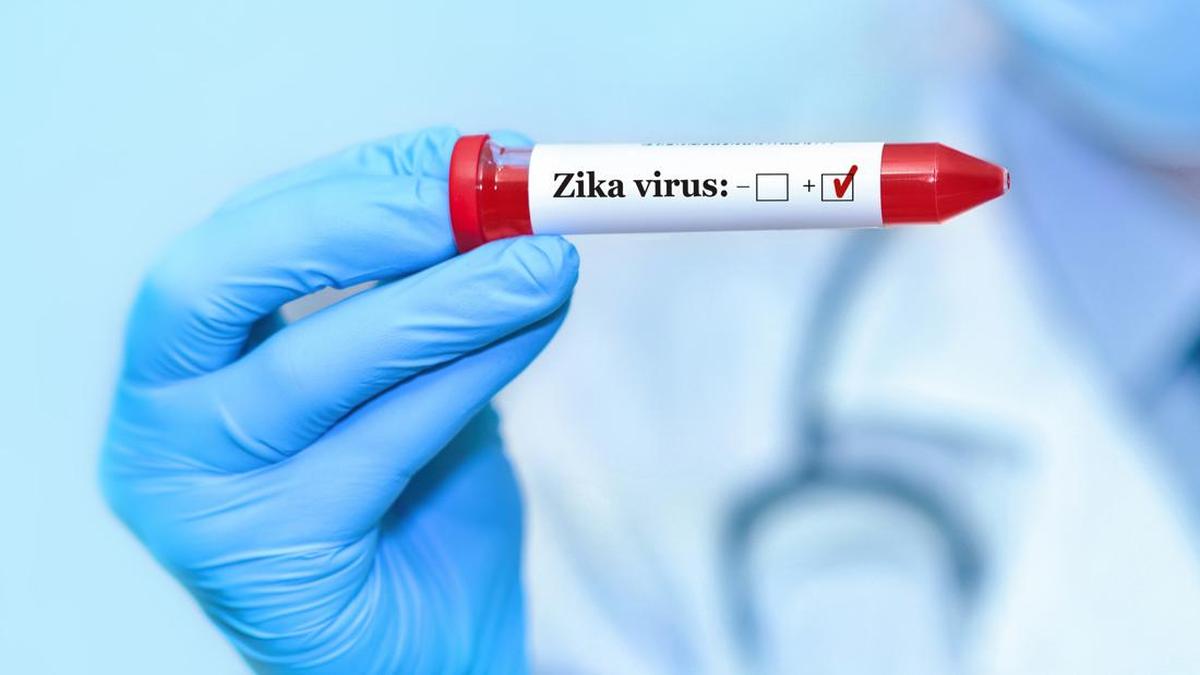 ---
Kemenkes RI Menanggapi Peringatan CDC AS Terkait Virus Zika di Bali

---
