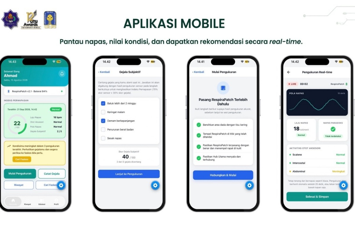 Inovasi RespiraTB dari Mahasiswa UII untuk Pemantauan Gejala TBC Secara Real-Time