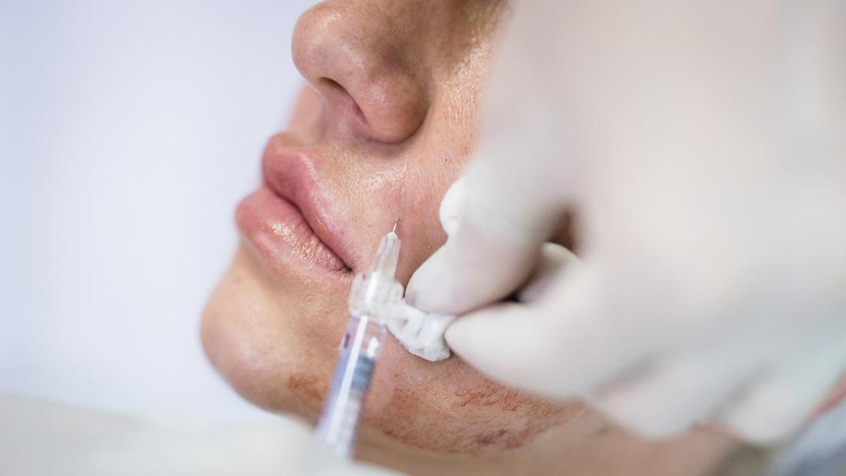 Perdebatan Skin Booster Kolagen dari Jaringan Kulit Mayat di Media Sosial