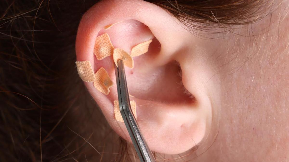 Fenomena Ear Seeds di Kalangan Idol K-Pop untuk Mengatasi Stres